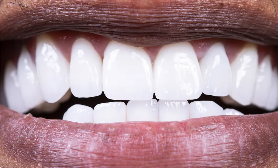 How Food Can Shape the Microbial Ecosystem Inside Your Mouth
